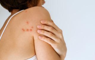 How To Prevent Bringing Bed Bugs Home